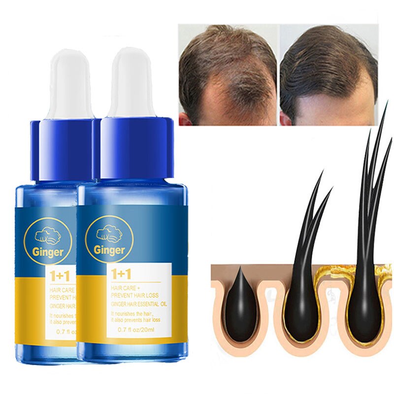 Hair Care Hair Growth Essential Oils/Authentic Hair Loss Liquid